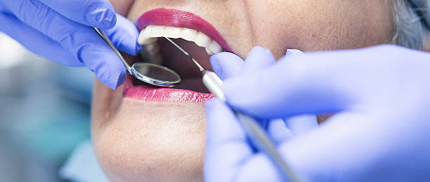 Best Emergency Treatment for Toothache in Summit, NJ